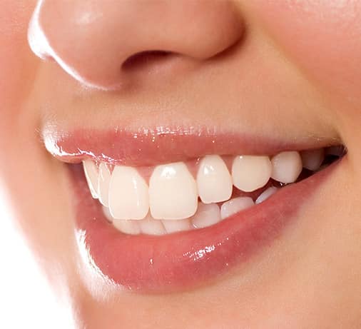 سفید کردن دندان ها به روش طبیعی